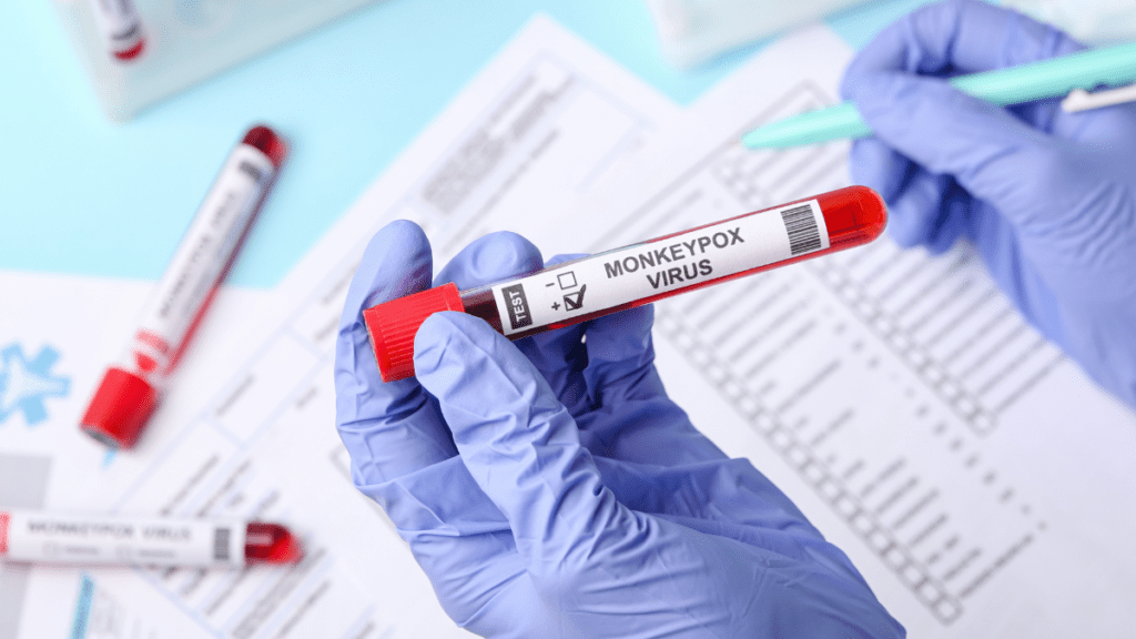 Five new cases of monkeypox have been identified in Delaware.